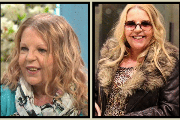 Sally Thomsett Face Illness: Truth Rumors and Verified Facts